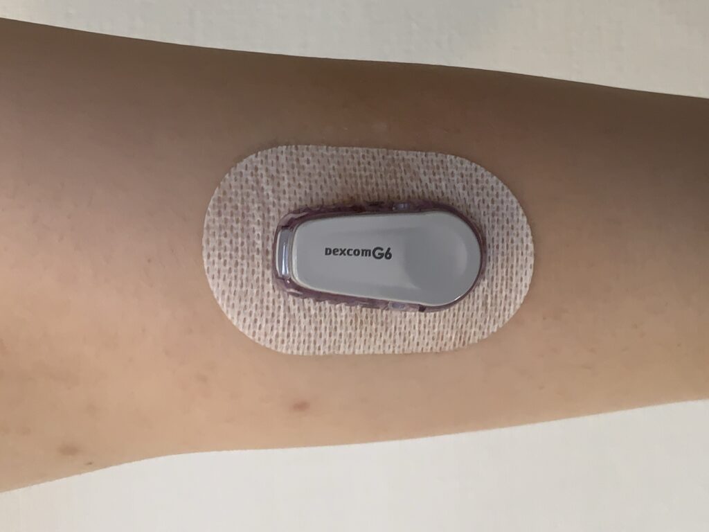 Dexcom G6