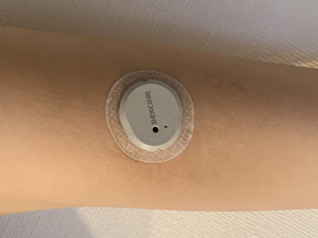 Dexcom G7